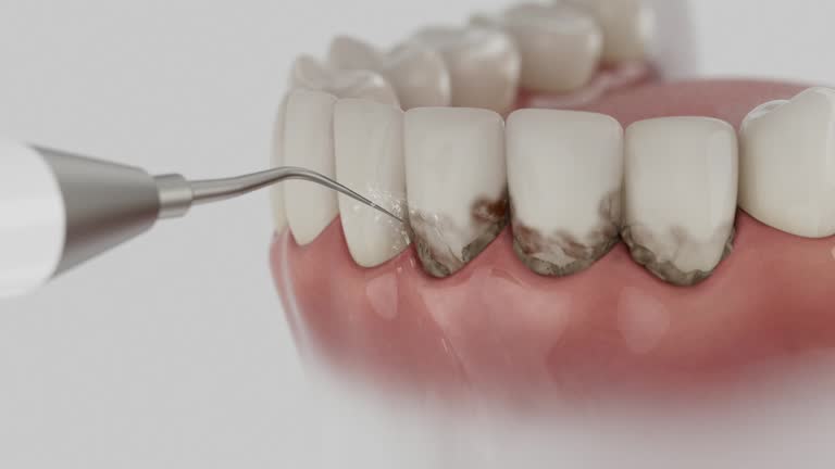 Trusted Dental Crowns And Bridges service in Tehachapi, CA - Dentist Open Now